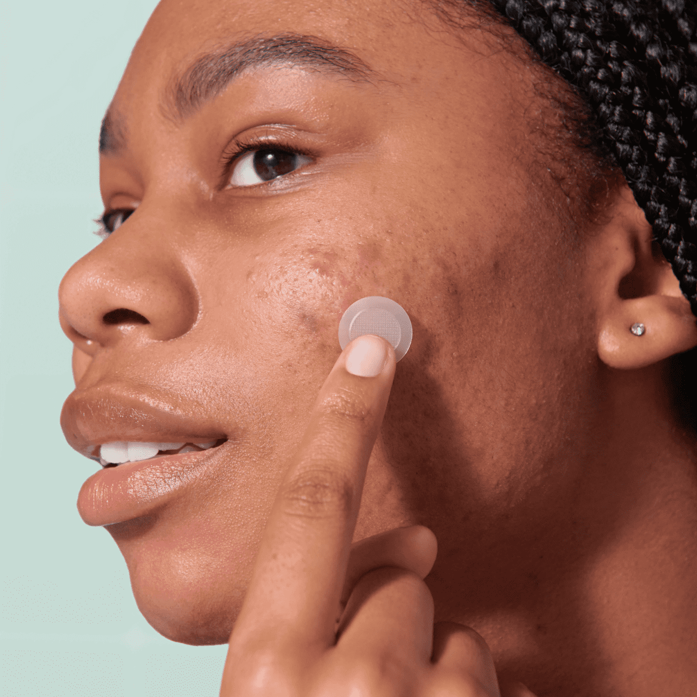 Mighty Patch™ for Early-Stage Blemishes - Quick Skin Care